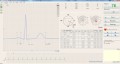 btl_ekg_c600_netmed_zaopatrzenie_medyczne(2).jpg