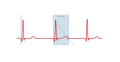 btl_ekg_c600_netmed_zaopatrzenie_medyczne(9).jpg
