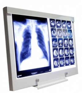 Negatoskop LED NGP 21 SLIM z podstawką na biurko
